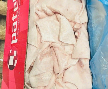 MỠ LƯNG TBN