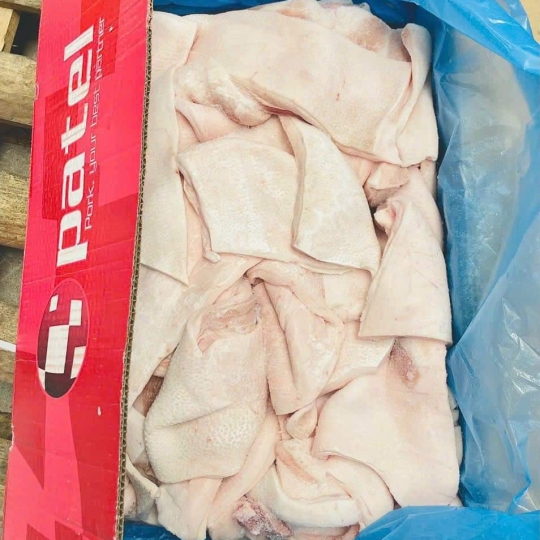 MỠ LƯNG TBN